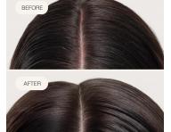 Bezoplachov� sprej pro hydrataci a zklidn�n� poko�ky hlavy Goldwell Dualsenses Scalp Specialist Rebalance & Hydrate Fluid - 150