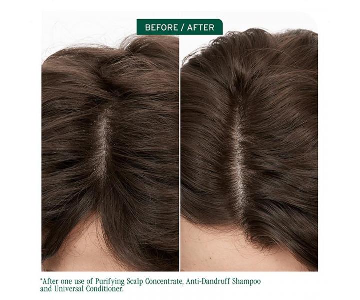 Kondicionér pro zdravou vlasovou pokožku Biolage Scalp Sync Universal Conditioner - 236 ml