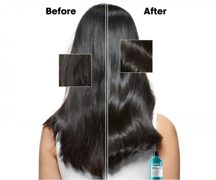 Čisticí šampon proti lupům Loréal Professionnel Scalp Advanced Anti-Dandruff - 500 ml