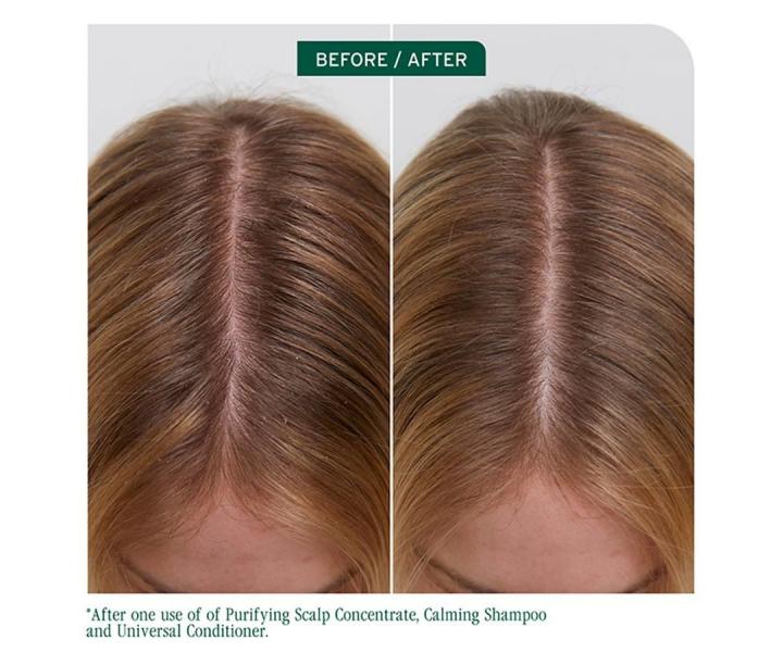 Zklidňující šampon pro suchou a citlivou pokožku hlavy Biolage Scalp Sync Calming Shampoo - 400 ml