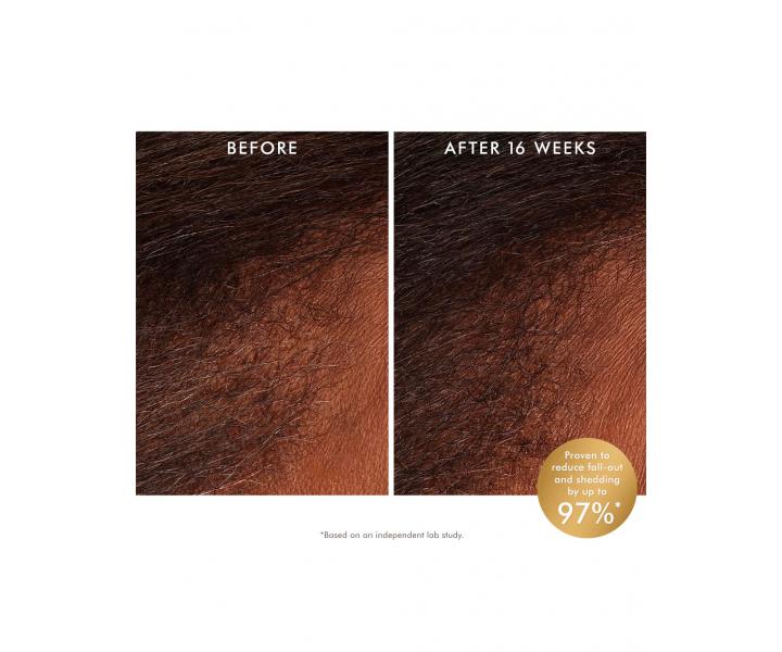 Bezoplachov revitalizan tonikum pro zdravou pokoku hlavy Moroccanoil Scalp Revitalizing - 100 ml