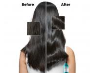Čisticí šampon proti lupům Loréal Professionnel Scalp Advanced Anti-Dandruff - 300 ml