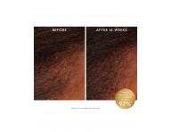 Bezoplachov revitalizan tonikum pro zdravou pokoku hlavy Moroccanoil Scalp Revitalizing - 100 ml