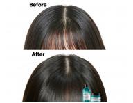 Šampon a maska 2v1 pro mastící se vlasovou pokožku Loréal Professionnel Scalp Advanced - 250 ml