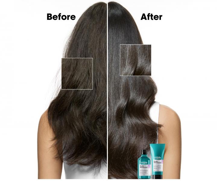 Šampon pro zklidnění vlasové pokožky Loréal Professionnel Scalp Advanced Anti-Discomfort - 500 ml