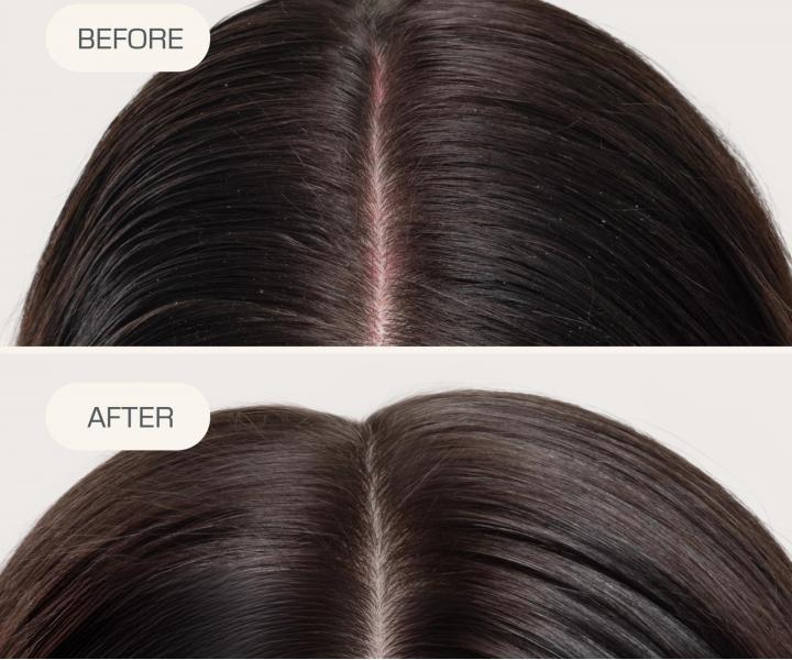 Bezoplachov� sprej pro hydrataci a zklidn�n� poko�ky hlavy Goldwell Dualsenses Scalp Specialist Rebalance & Hydrate Fluid - 150