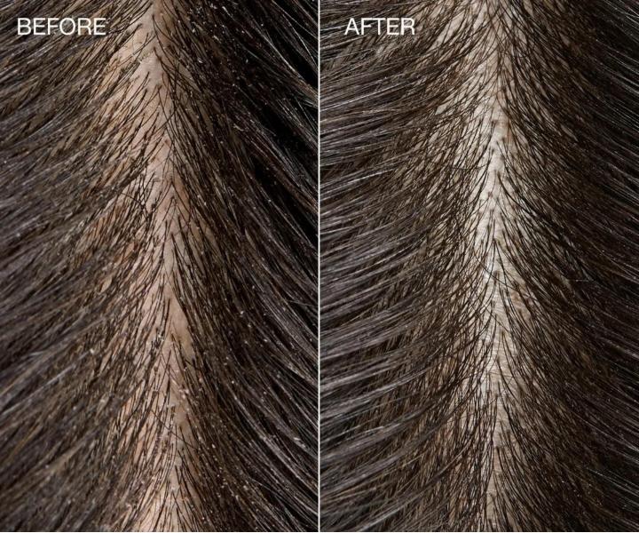 Pěnivý peeling na pokožku hlavy Paul Mitchell Tea Tree Special Detox - 184 g